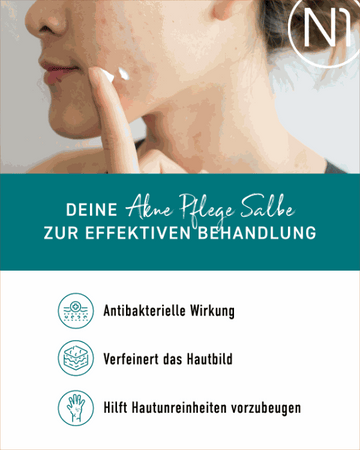 N1 Akne Pflege Salbe zur effektiven Behandlung von Hautunreinheiten, antibakteriell, verfeinert das Hautbild.