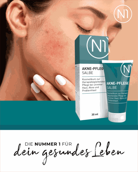 N1 Akne Pflege Salbe, 150ml Tube mit Verpackung, geeignet für unreine und empfindliche Haut, antibakterielle Wirkung, hergestellt in Deutschland.