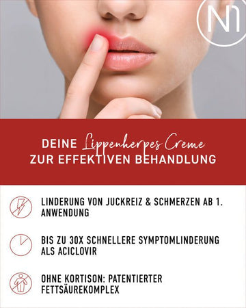 N1 Herpes Creme zur effektiven Behandlung von Lippenherpes, schnelle Linderung von Juckreiz und Schmerzen, ohne Kortison.