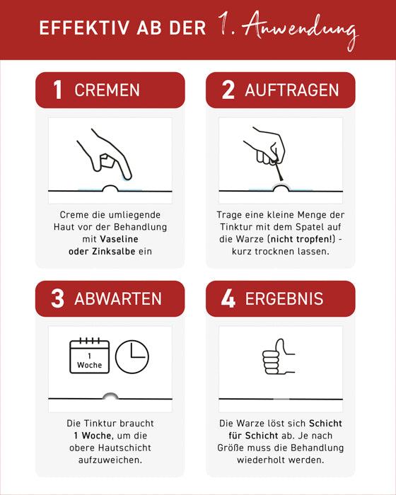 Effektiver Ablauf der Anwendung von N1 Warzen Tinktur in vier Schritten: Eincremen, Auftragen, Abwarten, Ergebnis.