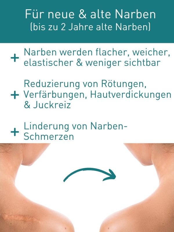 N1 Narben Gel 19 g - N1 - SHOP
