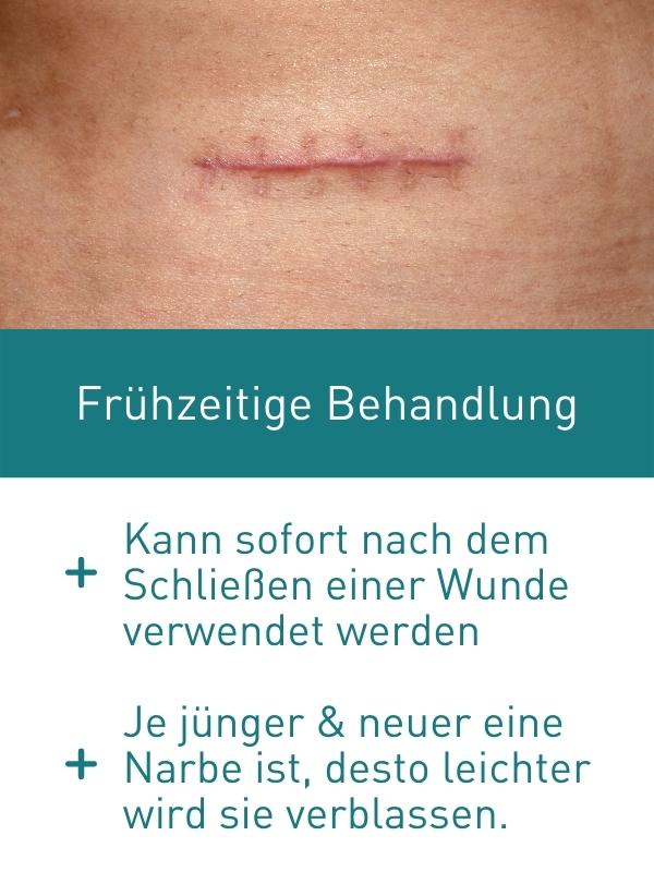 N1 Narben Gel 19 g - N1 - SHOP