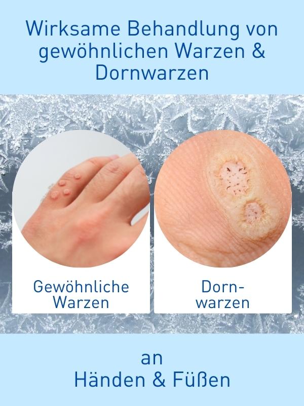 N1 WARZEN VEREISER, 3x38 ml - N1 - SHOP