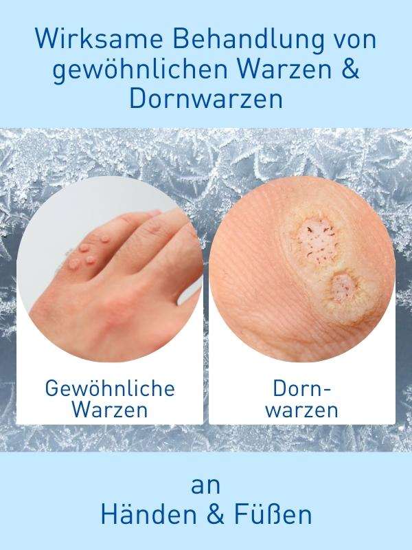 N1 WARZEN VEREISER, 3x38 ml - N1 - SHOP