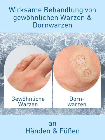 N1 WARZEN VEREISER, 5x38 ml - N1 - SHOP