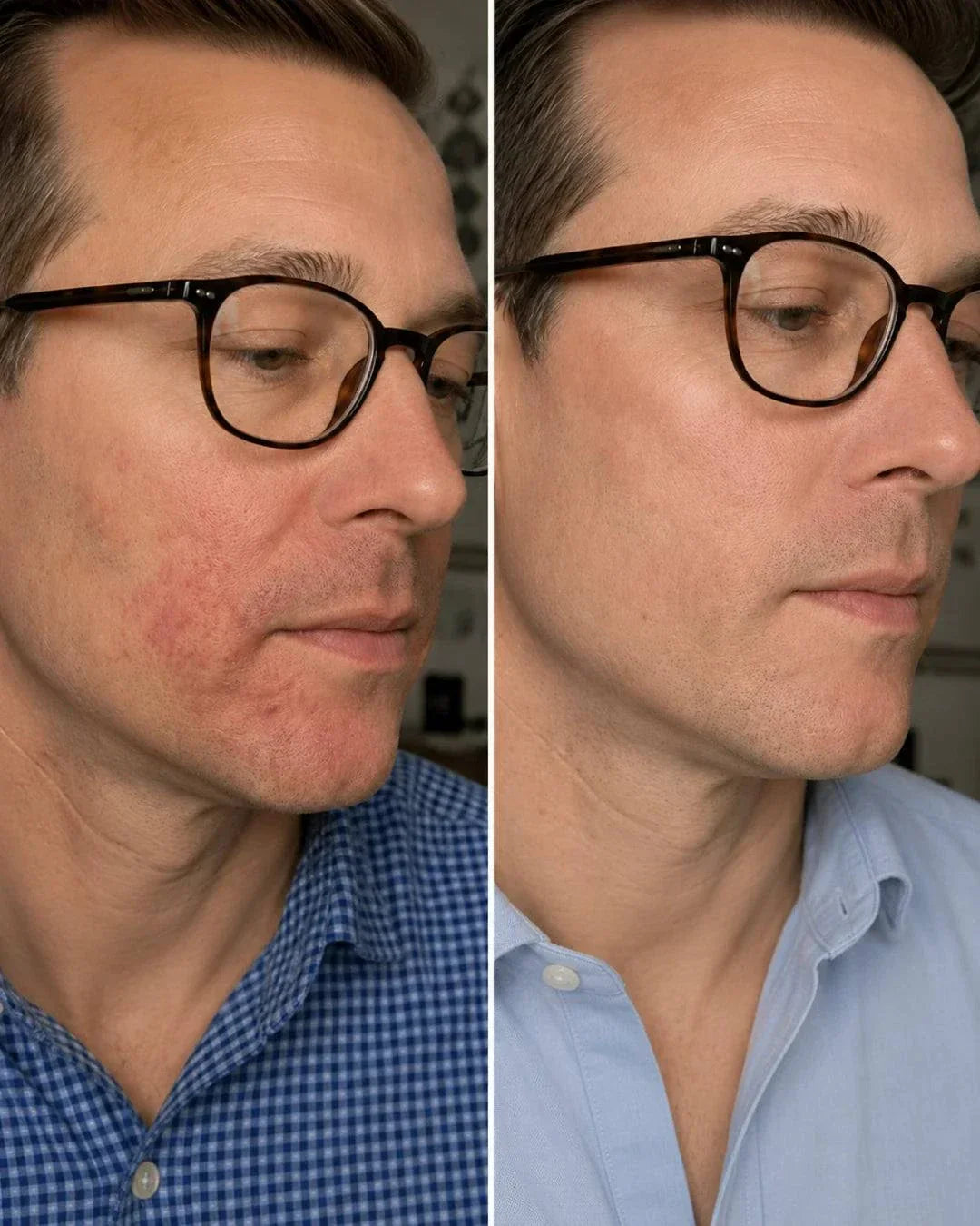 N1 My Coldplasma Skin Beauty Booster Gerät für Zuhause