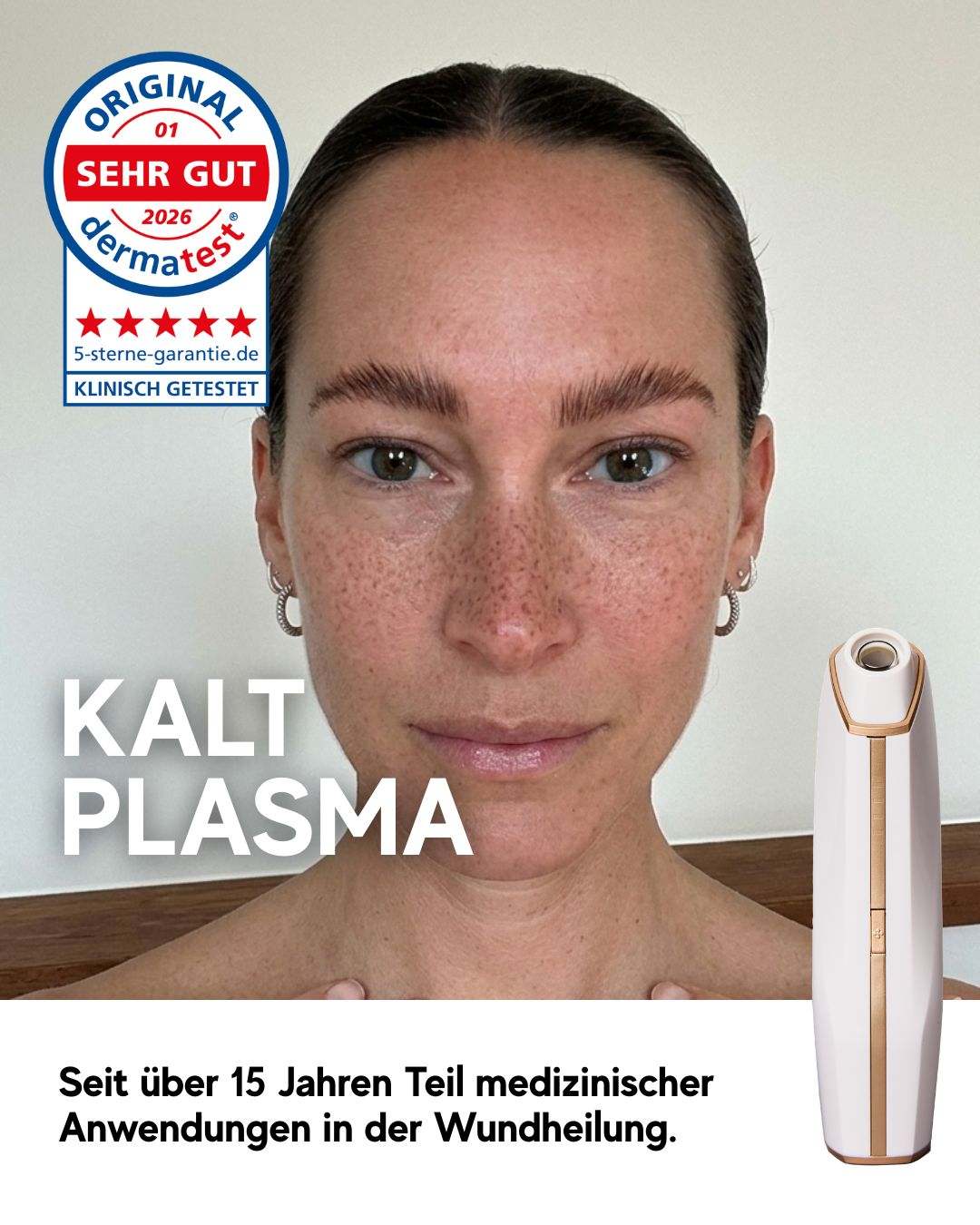 N1 My Coldplasma Gerät für Hautverschönerung und Beauty Booster