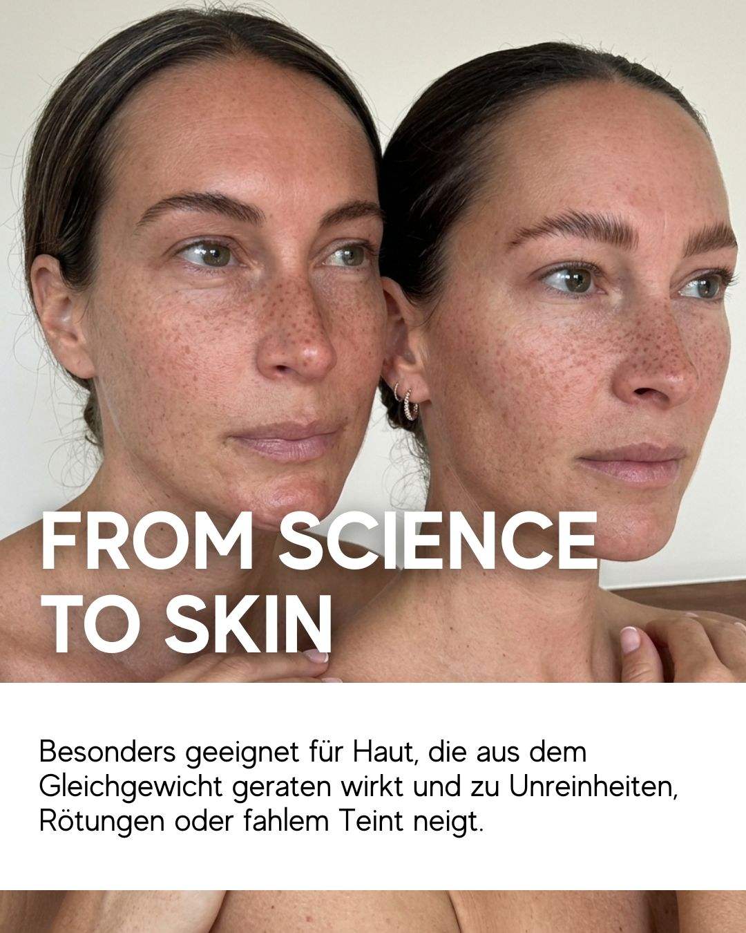 N1 My Coldplasma Home Gerät zur Hautverschönerung und Hautpflege Booster
