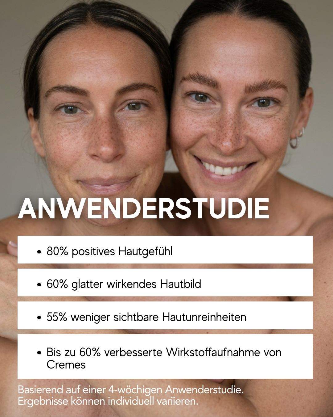 N1 My Coldplasma Home Skin Beauty Booster Gerät für Hautpflege