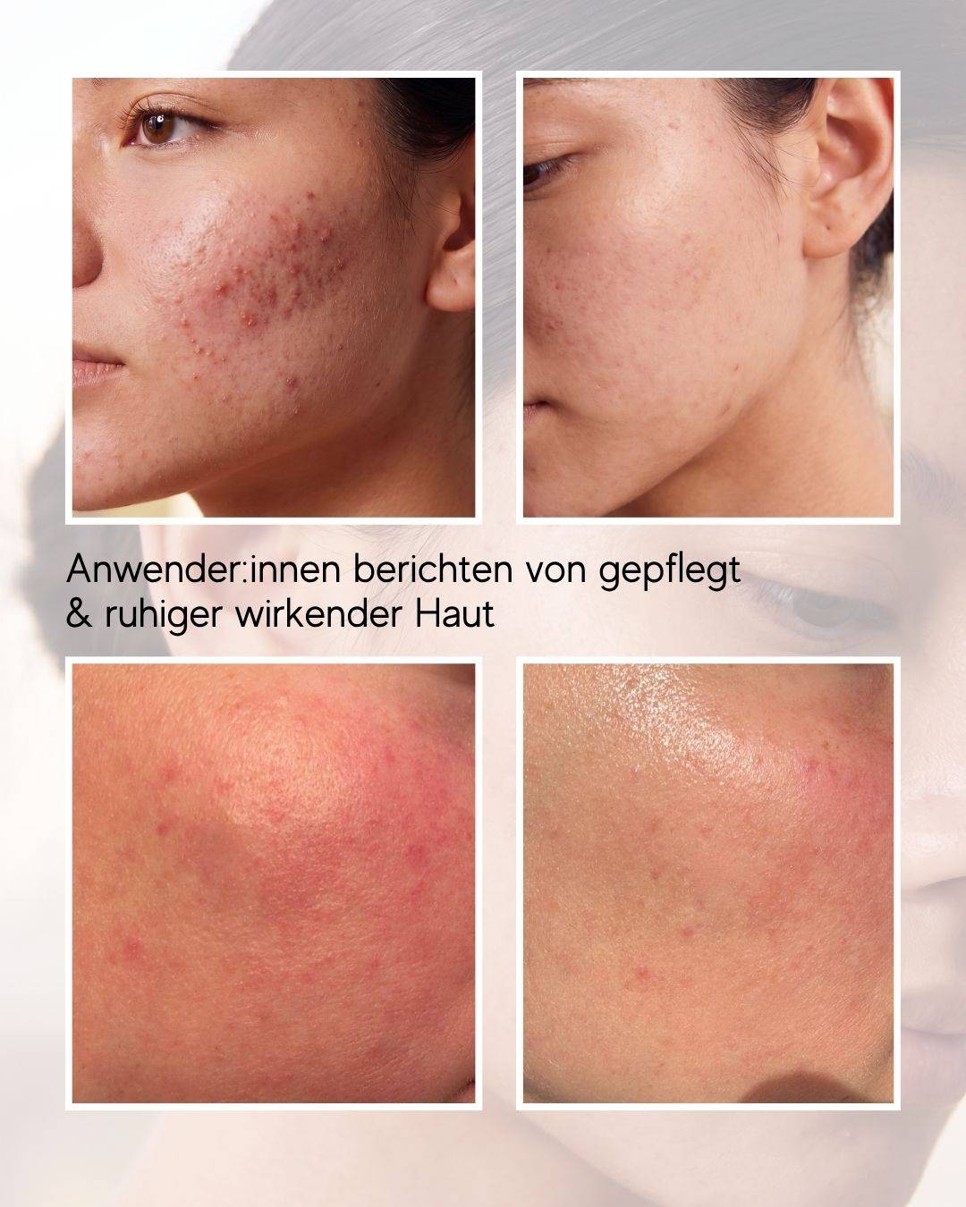 N1 My Coldplasma Skin Beauty Booster Gerät für Zuhause