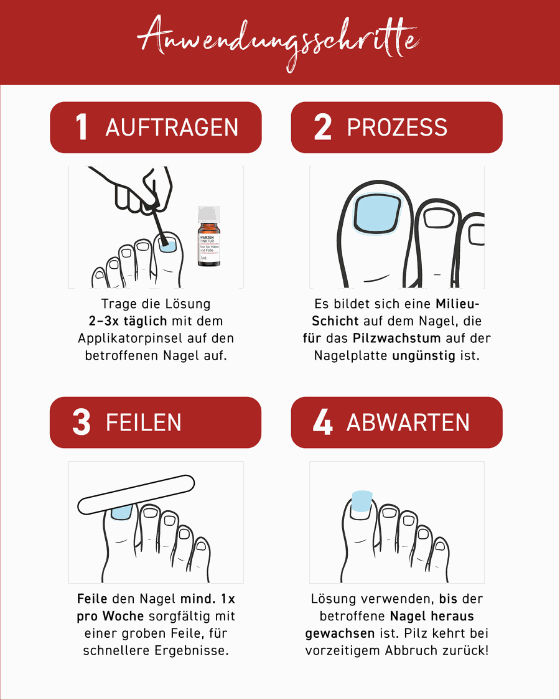 Anwendungsschritte der N1 Nagelpilz Lösung: Auftragen, Prozess starten, Feilen, Abwarten.