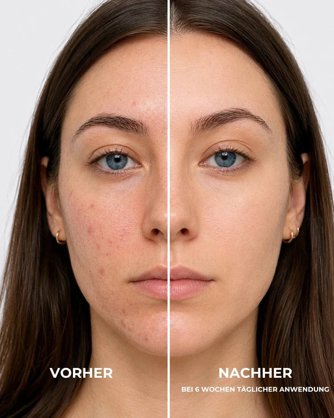 N1 My Coldplasma Skin Beauty Booster Gerät für zu Hause