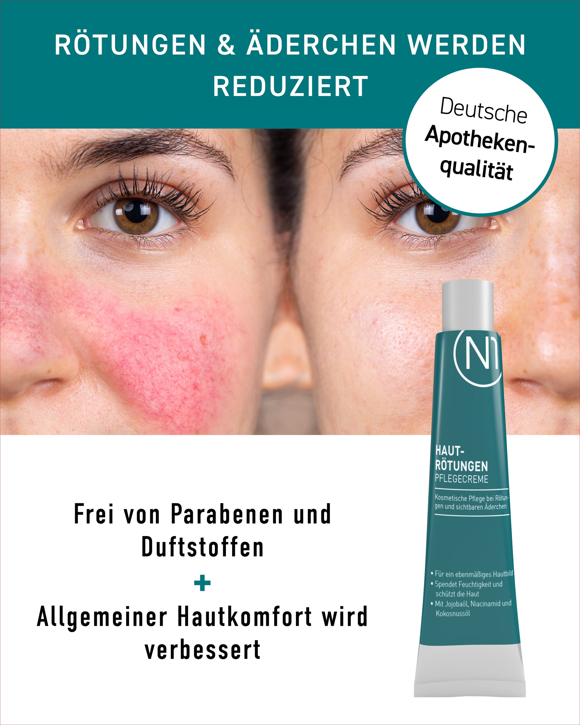 N1 Hautrötungen Pflegecreme, 30 ml - N1 - SHOP