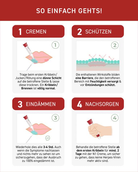 N1 Herpes Creme, Anleitung zur Anwendung in vier Schritten: Cremen, Schützen, Eindämmen, Nachsorgen.