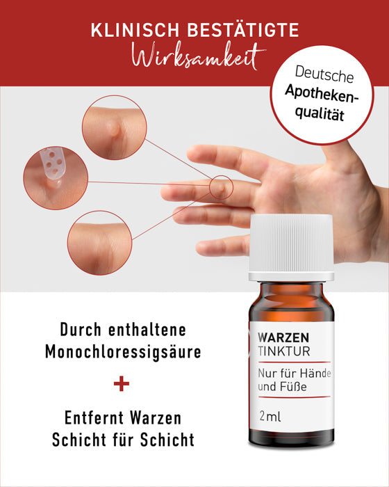 N1 Warzen Tinktur, 2 ml Flasche, klinisch bestätigte Wirksamkeit, entfernt Warzen schmerzfrei, deutsche Apothekenqualität.