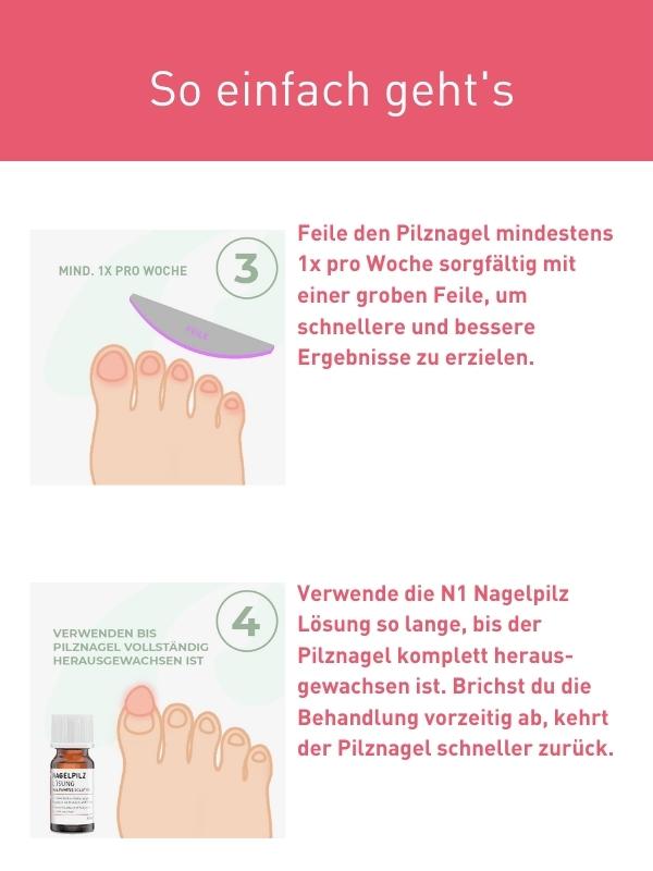 N1 Nagelpilzlösung mit patentiertem Wirkstoff, 10 ml - N1 - SHOP