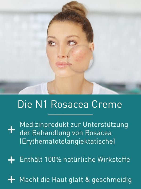 N1 Rosacea Creme, 150 ml - N1 - SHOP